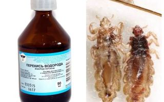 Peroxyde d'hydrogène des poux et des lentes