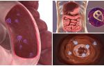 Où sont les Giardia dans le corps humain