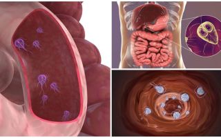 Où sont les Giardia dans le corps humain