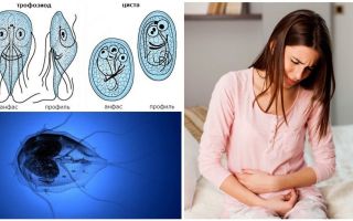 Comment puis-je obtenir Giardia