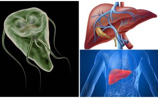 Giardia dans le foie - symptômes et traitement