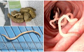 À quoi ressemblent les vers ronds dans les excréments humains?