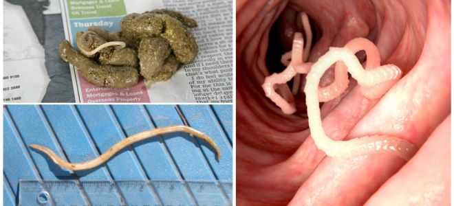 À quoi ressemblent les vers ronds dans les excréments humains?