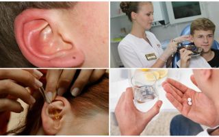 Tique dans l'oreille d'une personne: symptômes et traitement