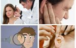 Que faire si un cafard montait à l'oreille