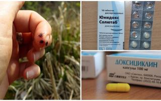 Comment prendre la doxycycline avec une morsure de tique