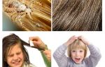 Que faire si un enfant a des poux