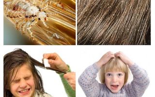 Que faire si un enfant a des poux