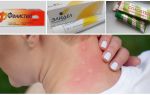 Comment frottis des piqûres de moustiques