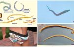 Différences Ascaris des oxyures et autres vers