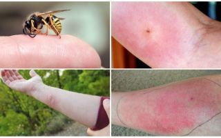 Que faire si une guêpe ou un mors d'abeille