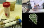 Comment passer correctement les matières fécales sur Giardia, méthodes d'analyse