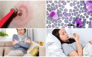 Ehrlichiose monocytaire chez l'homme