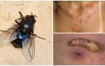 Une mouche qui pond des larves sous la peau humaine