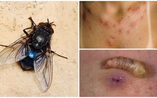 Une mouche qui pond des larves sous la peau humaine