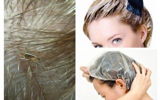 Les poux mourront-ils si vous teignez les cheveux?
