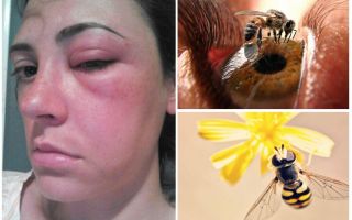 Et si une abeille mordait dans l'oeil et qu'elle gonflait