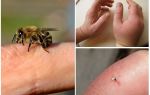Quelle est la piqûre d'abeille utile pour une personne?