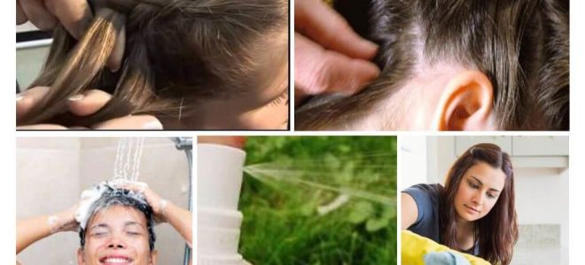 Moyens pour prévenir les poux chez les enfants