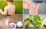 Comment oindre un enfant piqûres de moustiques