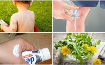 Comment oindre un enfant piqûres de moustiques