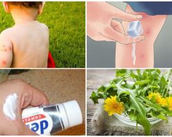 Comment oindre un enfant piqûres de moustiques