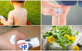 Comment oindre un enfant piqûres de moustiques