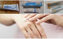 Comment et quoi se débarrasser des piqûres de moustiques à la maison