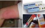 Que faire si, après la piqûre d'un moustique, la jambe est gonflée