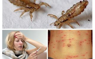 Quelles maladies portent les poux