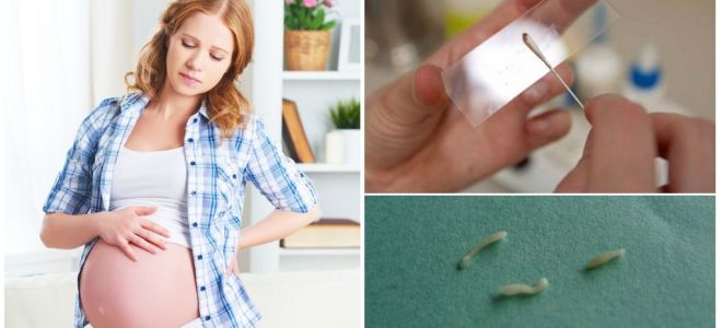 Comment traiter les oxyures chez les femmes enceintes