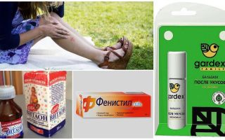 Que faire contre les piqûres de moustiques? Ne pique pas
