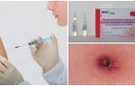 Immunoglobuline contre l'encéphalite à tiques