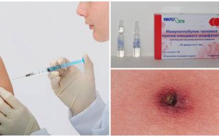 Immunoglobuline contre l'encéphalite à tiques