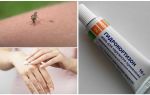 Pommade à l'hydrocortisone pour les piqûres de moustiques