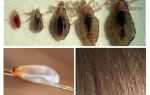 Comment distinguer vivre des lentes mortes