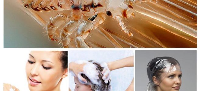 Shampooings Pédiculose pour enfants et adultes