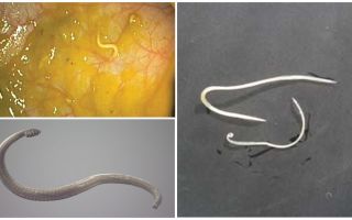Voies d'infection par les oxyures