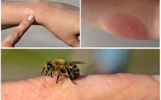 Réaction allergique aux piqûres d'abeilles, que faire