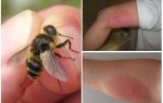 Que se passe-t-il si la morsure de mouche de la mouche des mouches est gonflée et rouge