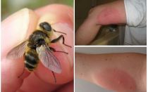 Que se passe-t-il si la morsure de mouche de la mouche des mouches est gonflée et rouge