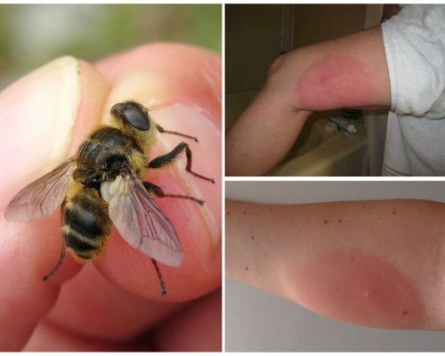 Que se passe-t-il si la morsure de mouche de la mouche des mouches est gonflée et rouge