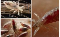 Quels rêves de poux dans mes cheveux