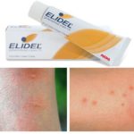 Elidel contre les piqûres de punaises