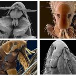 Puce au microscope