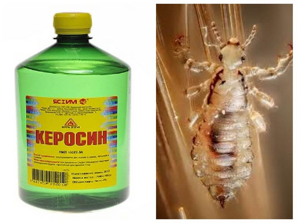 Kérosène pour les poux