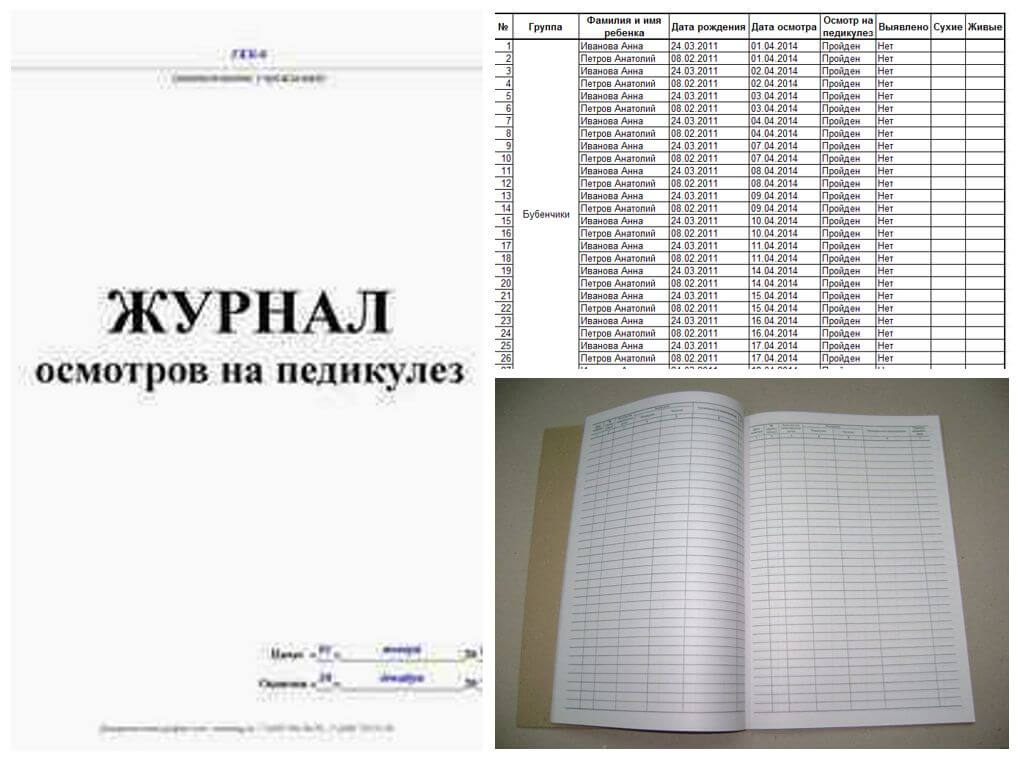 Journal d'examen de pédiculose