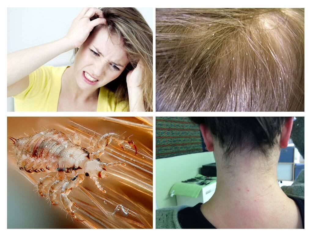 Maux de tête