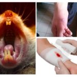 Morsure de souris