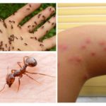 Piqûres d'insectes
